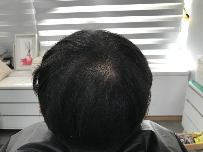 전