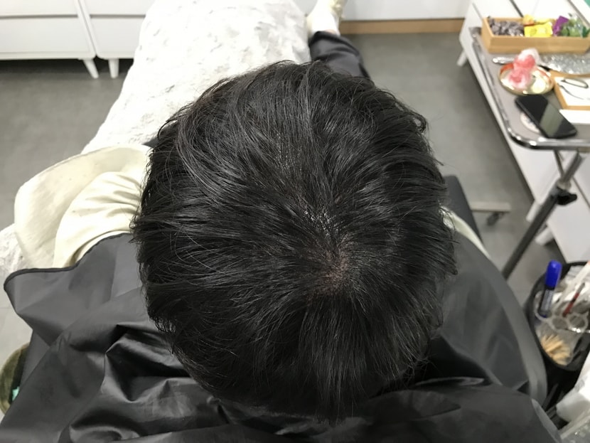 후