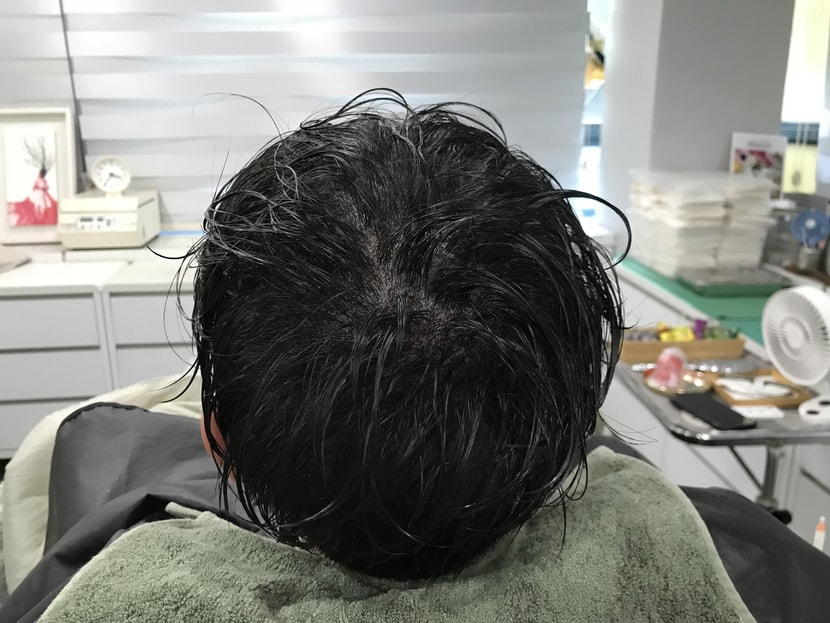 후