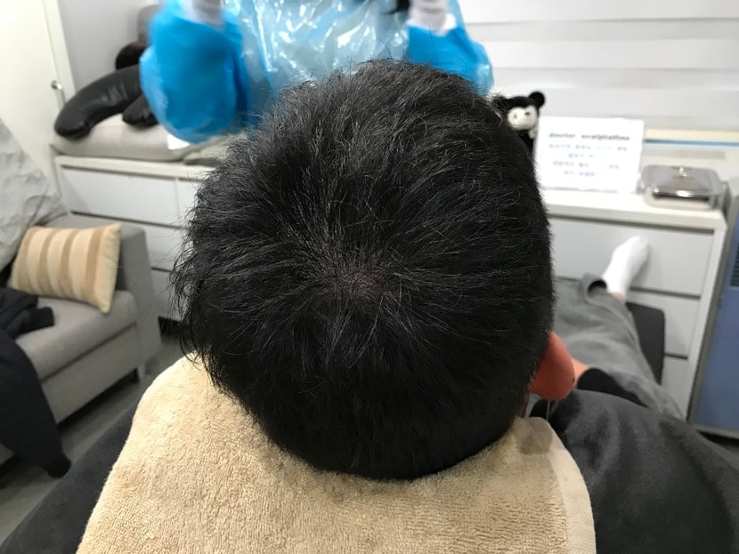 시술 후 드라이 해주신 상태입니다!