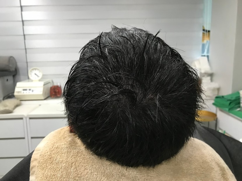 시술 후 샴푸한 상태입니다.