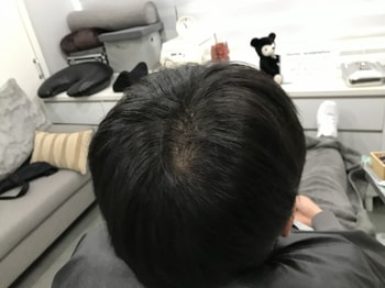 시술 전