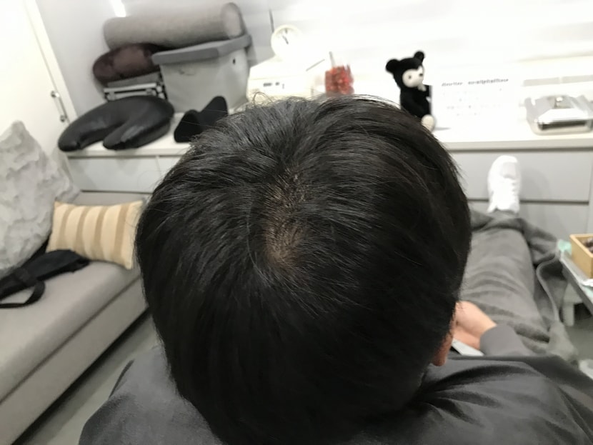 시술 전