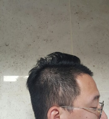 머리가 조금 자랐을때