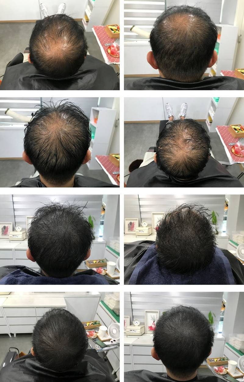 This is the first review of the scalp tattoo.