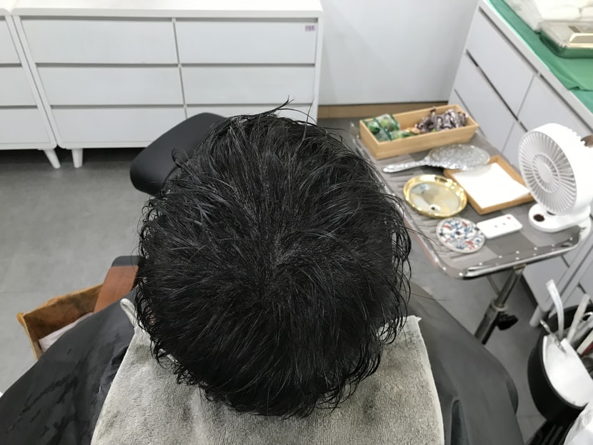 시술 후 젖은 머리