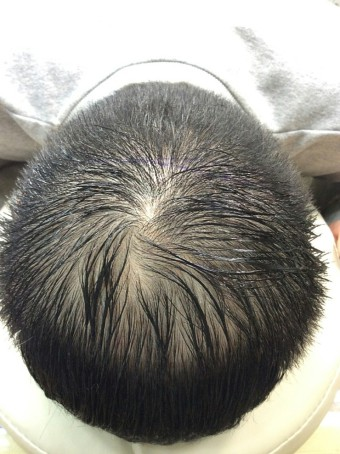 I'm posting a review of my scalp tattoo for a month ^^