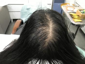 (하기 전)