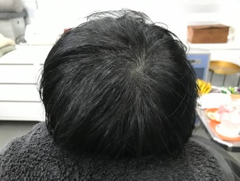 문신후 마른머리