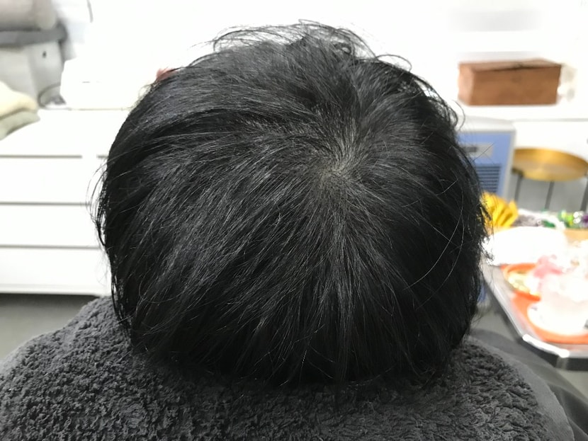 문신후 마른머리