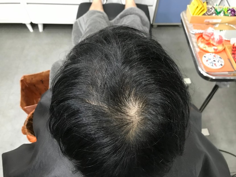 문신전 마른머리