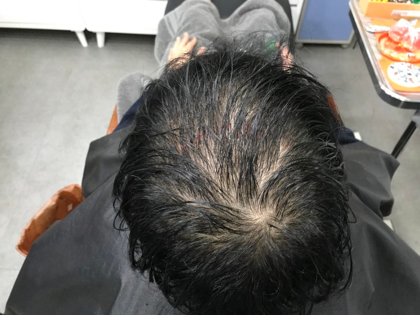 문신전 젖은머리