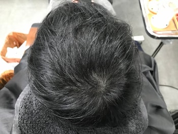 문신후 마른머리