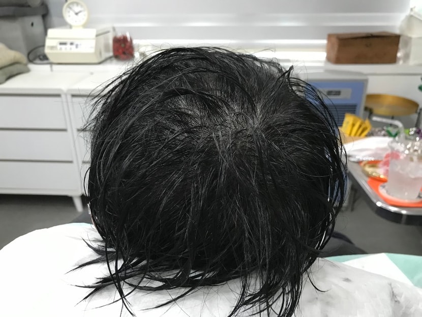 문신후 젖은머리