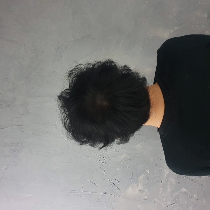후