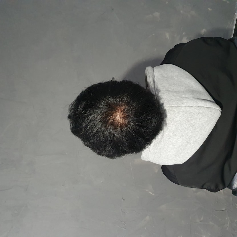 전