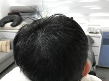 리터치 후