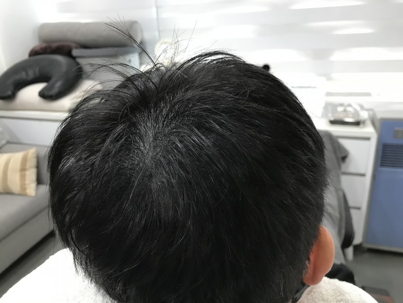리터치 후