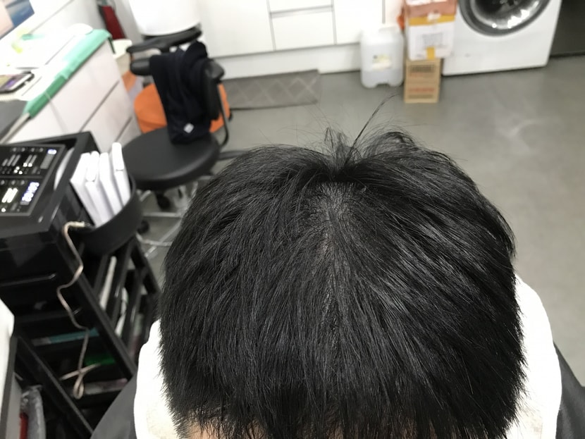 리터치 후 앞에서
