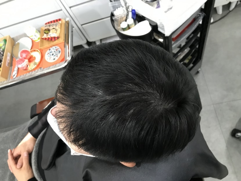 리터치 전 위에서