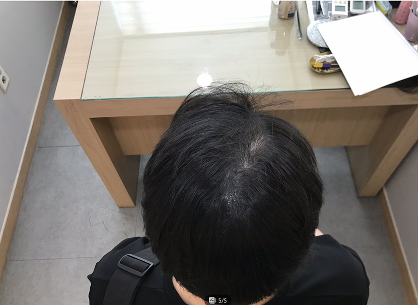 4년차