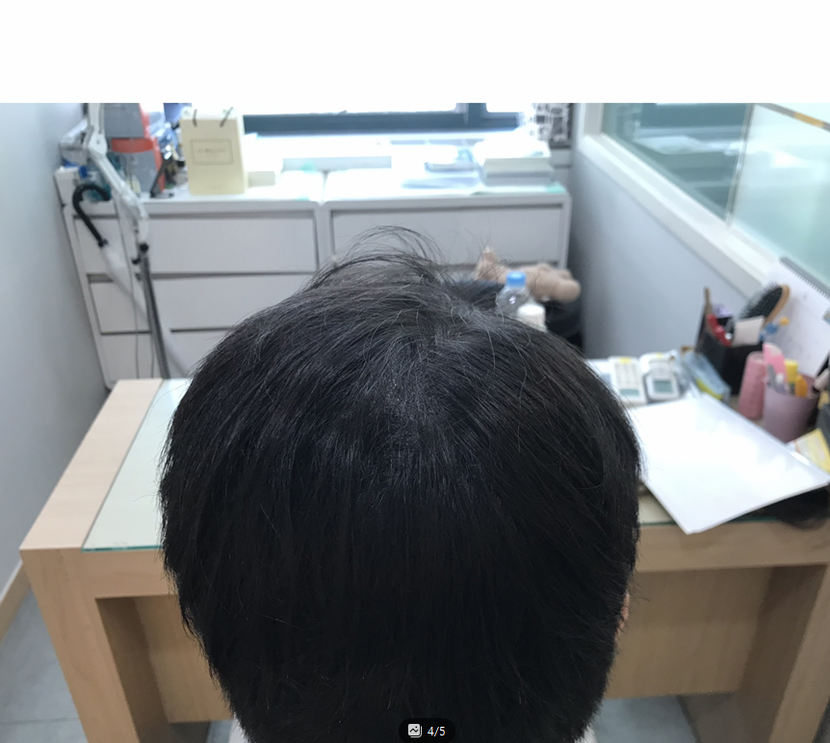 4년차