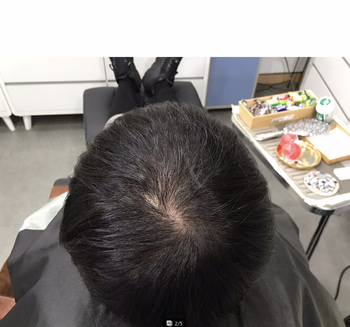 시술전