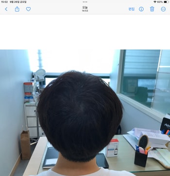(리터치 후)