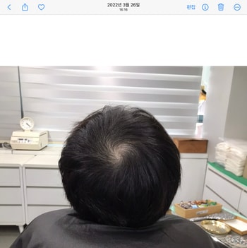 (시술 전)