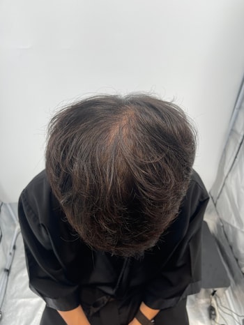 전