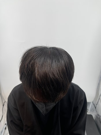 후