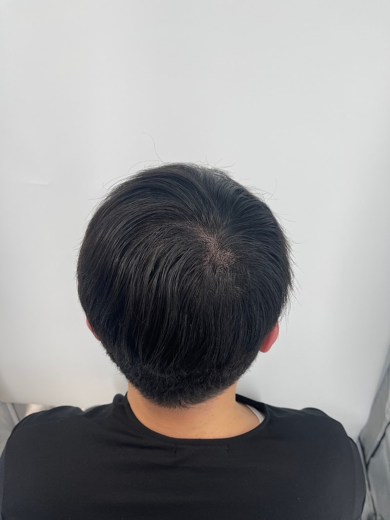 这是新发型SMP头皮纹身后记