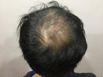 문신전