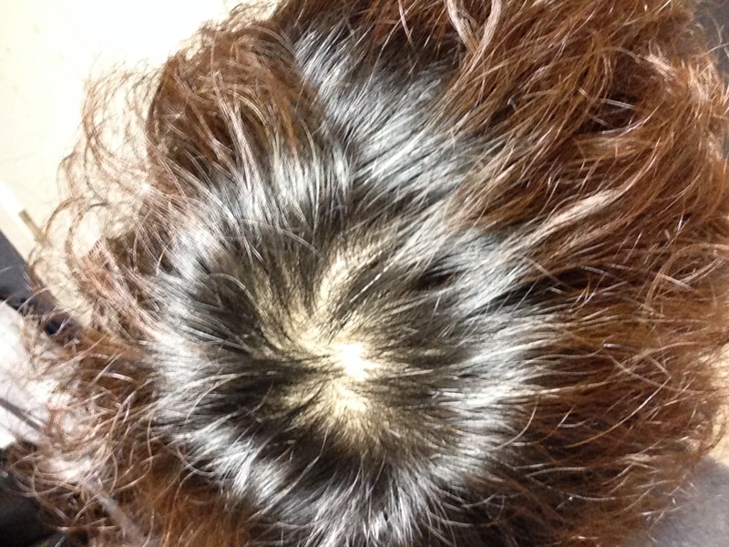 是头皮纹身一周后。