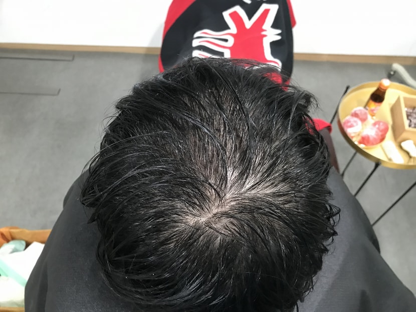 시술 전 젖은 머리2