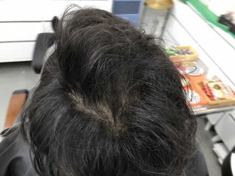 I'm posting a review of my scalp tattoo!