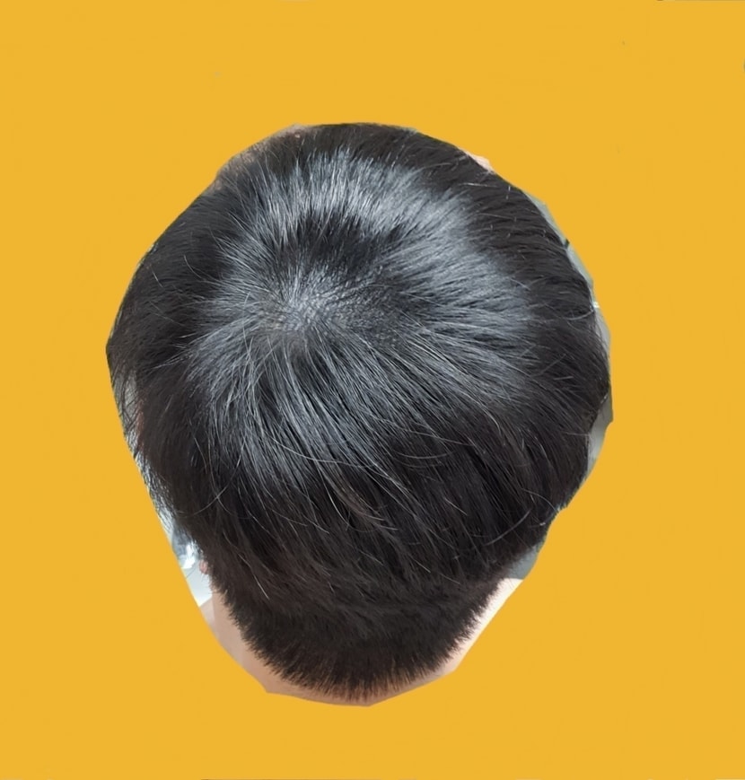 한달 후 집에서 찍은 사진입니다