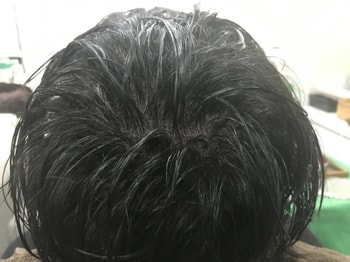 시술끝나고 샴푸후 사진입니다.