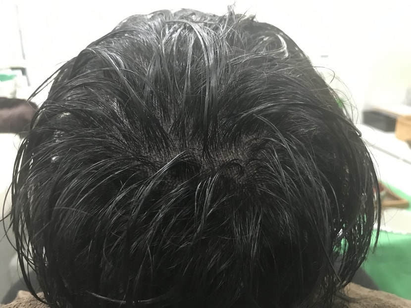 시술끝나고 샴푸후 사진입니다.