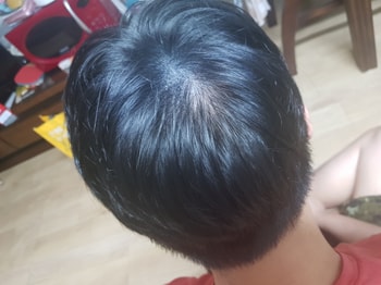 7/4