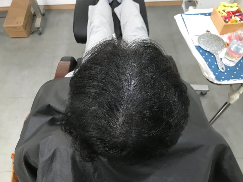 리터치 전