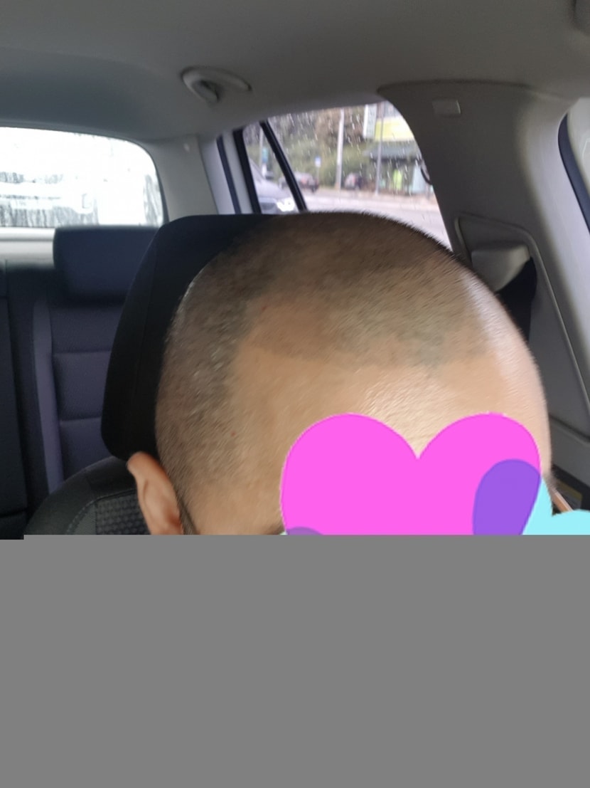 에프터3