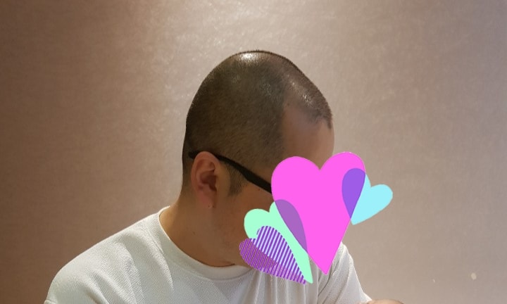 비포어2
