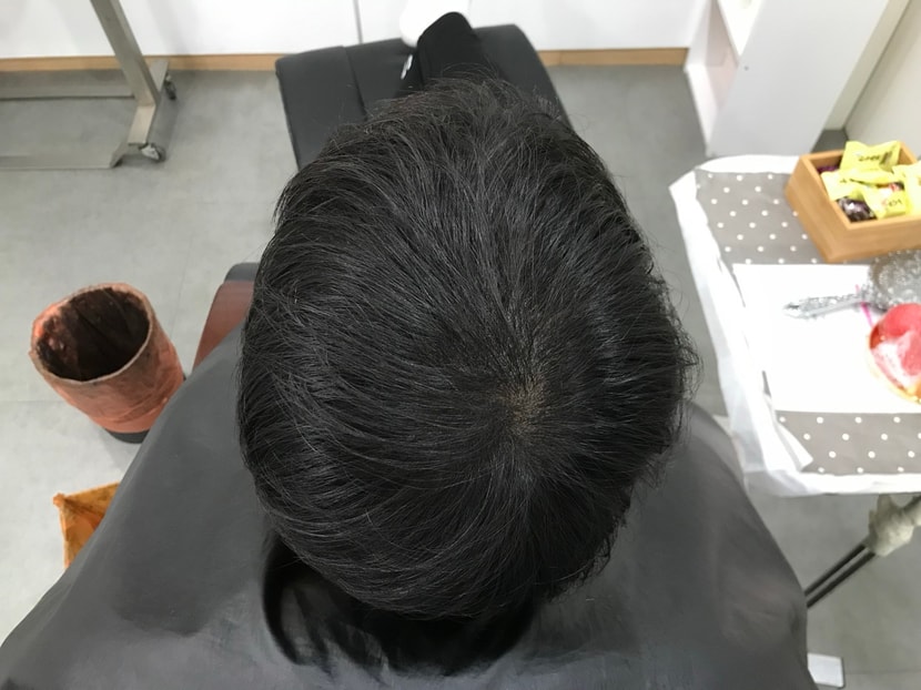 후