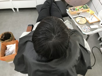시술 직후 