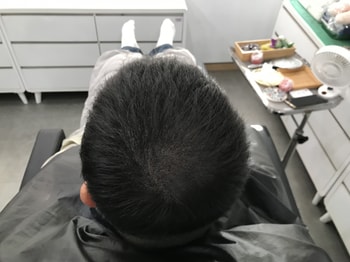 시술후(안젖은머리2)