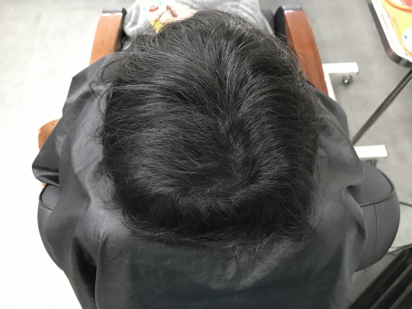 리터치 직후
