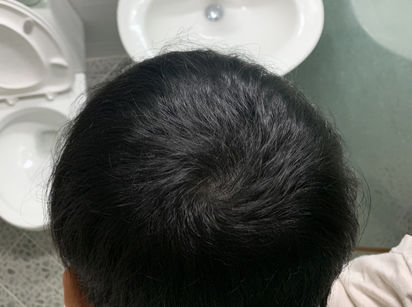 리터치 후 집에서