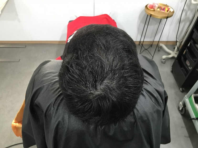 리터치 전 젖은 저의 머리 상태입니다