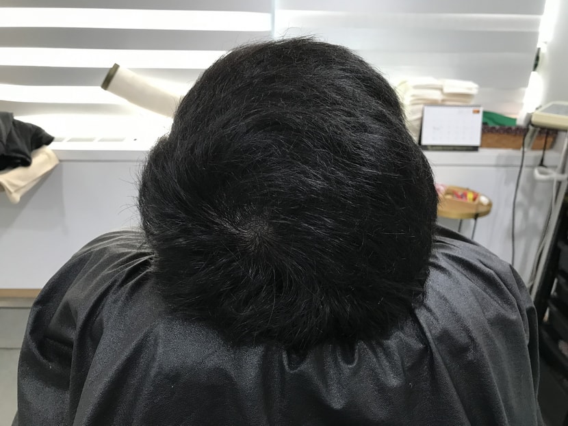 리터치 전 저의 머리 상태입니다!